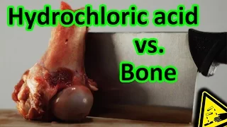 Hydrochloric Acid vs. Bone total decomposition 🍖