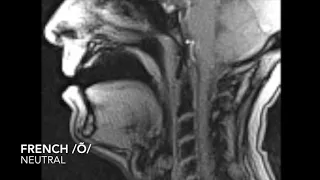 MRI Video of Soft Palate Movement