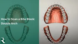 How to Scan a Bite Block (double arch)