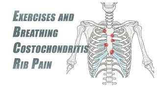 Exercises and Breathing Tips for Rib Pain | Costochondritis
