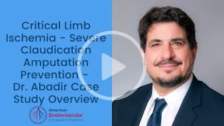 Critical Limb Ischemia - Severe Claudication Amputation Prevention - Dr. Abadir Case Study Overview