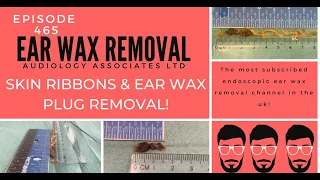 SKIN RIBBONS & EAR WAX PLUG REMOVAL - EP465