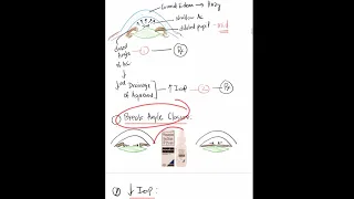 MCQ 2: Essentials in Acute Angle Closure Glaucoma  #Mustknow #UKMLA