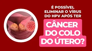 É possível eliminar o vírus do HPV após ter câncer de colo de útero?