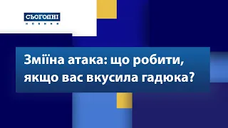 Зміїна атака: що робити, якщо вас вкусила гадюка?