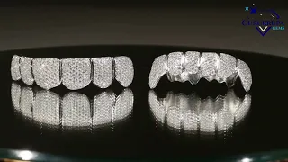 Fully moissanite sparkling round brilliant cut vvs clarity diamond iced out hiphop customize  grillz