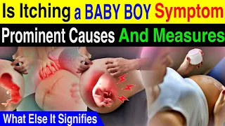 Itching - A Baby Boy Or Baby Girl Symptom During Pregnancy | What Else Itching During Pregnancy Mean