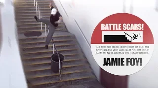 Jamie Foy's Battle Scars