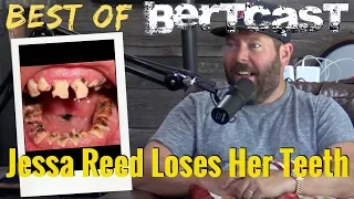 Jessa Reed Loses Her Teeth - Bertcast Clip