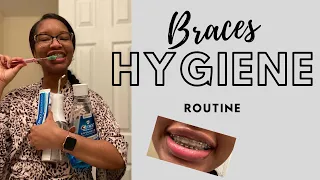 Clean my braces with me | Braces Cleaning Routine