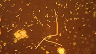 бактерии.MPG