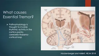 Essential Tremor: Basal Ganglia, Cerebellum & Thalamus