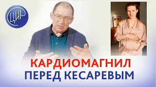 Когда отменять кардиомагнил (аспирин) перед кесаревым сечением? Отвечает Игорь Иванович Гузов.