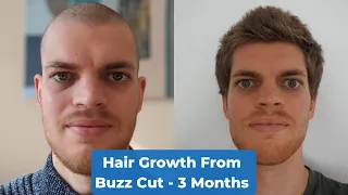 Hair Growth Time Lapse 3 Months - From Buzz Cut