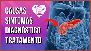 PANCREATITE - Causas, Sintomas e Tratamento