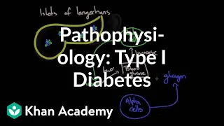 Pathophysiology - Type I diabetes | Endocrine system diseases | NCLEX-RN | Khan Academy