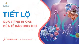 Tiết lộ quá trình di căn của tế bào ung thư trong cơ thể con người