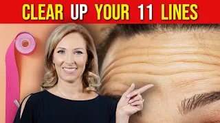 Face Taping for 11 Lines | Dr. Janine