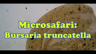 Microsafari: Bursaria truncatella