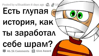 КОГДА ПО ТУПОСТИ ЗАРАБОТАЛ ШРАМ НА ВСЮ ЖИЗНЬ 😂