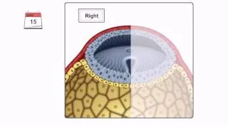 General Embryology - Detailed Animation On Gastrulation