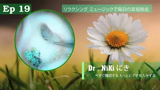 リラクシング ミュージックで毎日の耳垢除去 Candle ear wax removal .19