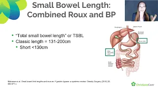 Optimal Intestinal Limb Length