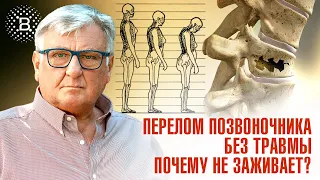 ПЕРЕЛОМ ПОЗВОНОЧНИКА БЕЗ ТРАВМЫ.ПОЧЕМУ НЕ ЗАЖИВАЕТ?