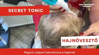 Drámai hajhullás után itt az önbizalom növelés!