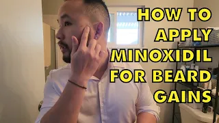How to Apply Minoxidil to Your Face to Grow a Real Beard