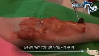 메디컬 다큐 7요일 - 3년 만의 외출- 근이영양증 외_#003