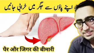 9 Things Your Feet Can Tell About Your Liver Problems | Jigar ki Garmi ki Alamat | #liver  #jigar