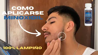 COMO APLICAR MINOXIDIL PARA CRECER BARBA