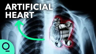 Permanent Artificial Hearts Are Closer Than You Think