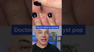 Doctor reacts to big cyst pop! #pimplepop #cystpop #dermreacts