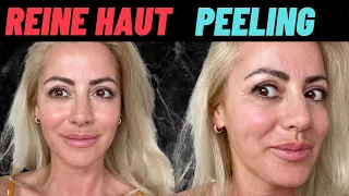 REINE HAUT BEKOMMEN mit diesen 4 ZUTATEN - Peeling für REINE HAUT machen + Tipps & Nachher Ergebnis