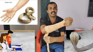 सांप ने काट लिया, अब क्या करें..? सर्पदंश का सही इलाज Snake bite first aid and treatment