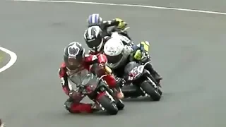 The Minibike Crash that Made a 10 Year Old World Famous!