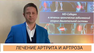 Артроз и артрит, устранение боли. Инъекционные препараты Guna MD Collagen в лечении артроза.