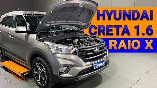 Creta 1.6: manutenção simples como a do HB20? | Raio X