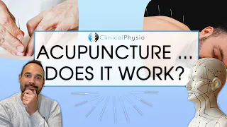 Does Acupuncture Work in Physiotherapy?! | Expert Physio Reviews the Evidence