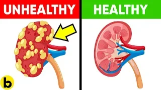 Eat THESE 13 SUPER Foods That Make Your Kidneys HEALTHY!