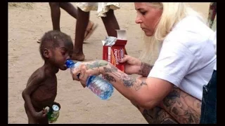 Aid Worker Saves Nigerian Toddler - Abandoned Because He's A "Witch"