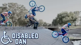 Disabled Dan - One Hip BMX Rider Inspiring The WORLD!