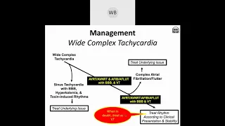 Wide Complex Tachyarrhythmias: Part 3- Algorithm for Differentiation