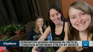 Edmonton woman fights for life after being struck by vehicle