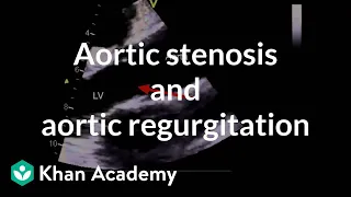 Aortic stenosis and aortic regurgitation | Circulatory System and Disease | NCLEX-RN | Khan Academy