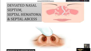 DEVIATED NASAL SEPTUM, SEPTAL HAEMATOMA, SEPTAL ABCESS