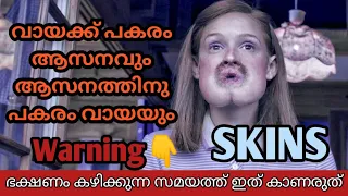 SKINS Movie explanation in Malayalam|R2Media