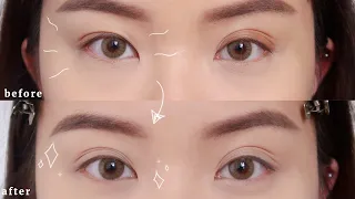 HOW I FIX MY UNEVEN EYELIDS NATURALLY 👀✨